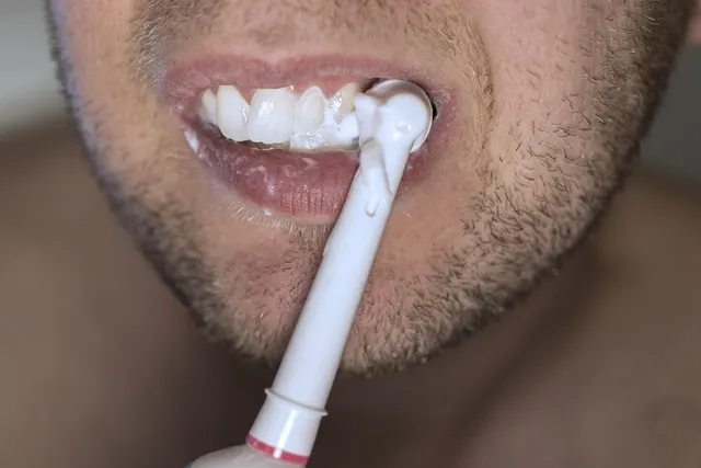 Extra Mouth Tray